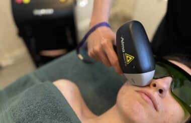 Epilazione Laser Soprano di Alma Laser